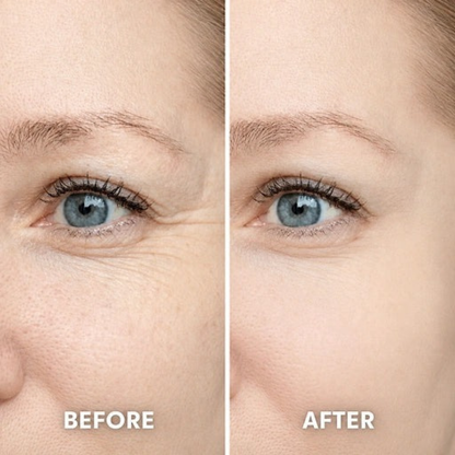 Fovarra™ Pink Collagen Volume Multi Balm